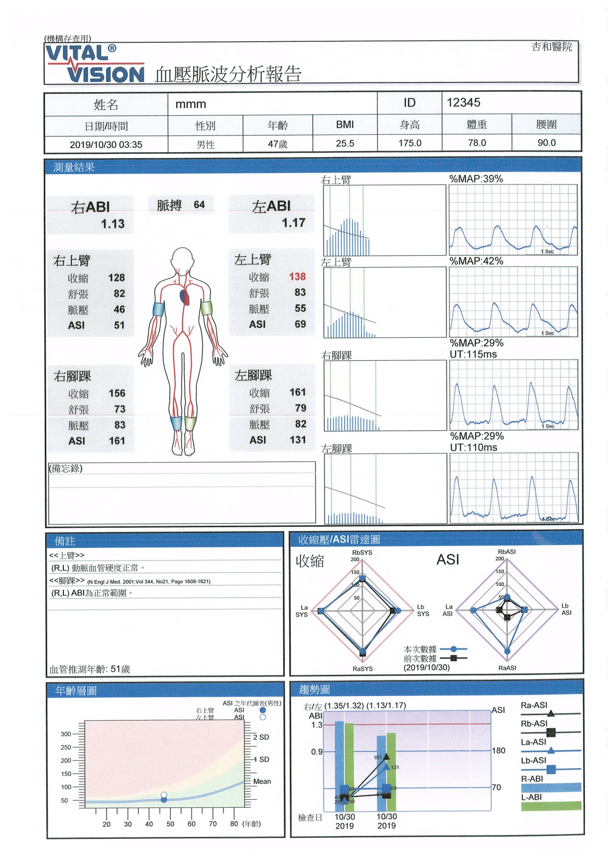 下肢周邊動脈硬度指數偵測ABI